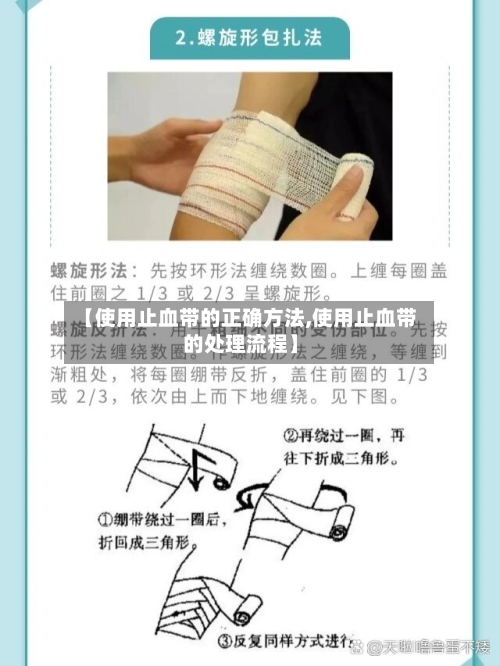 【使用止血带的正确方法,使用止血带的处理流程】-第1张图片
