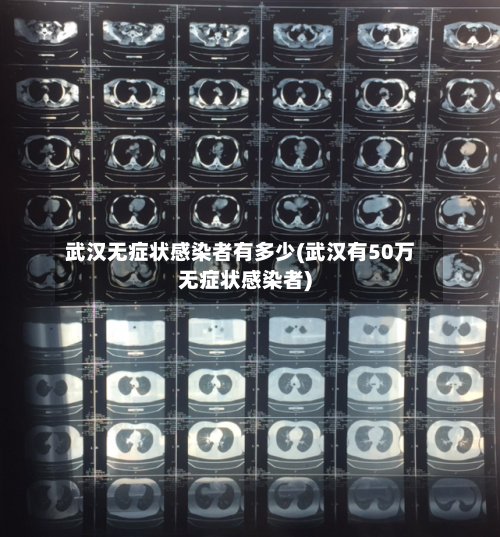 武汉无症状感染者有多少(武汉有50万无症状感染者)